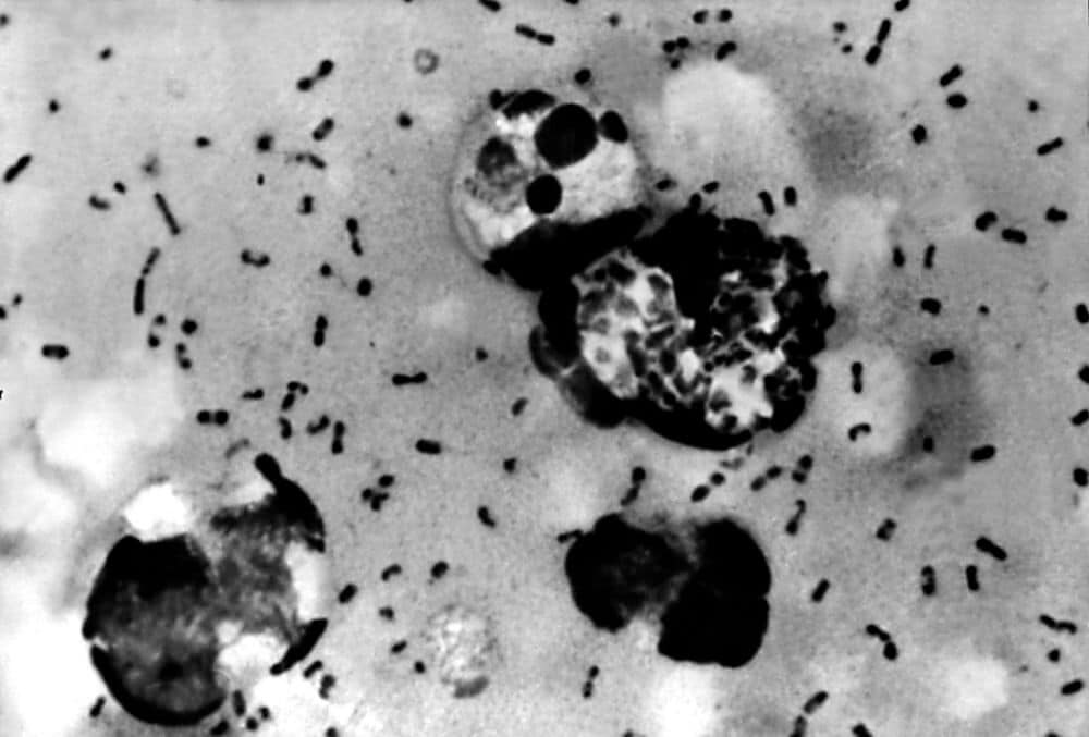 Yersinia pestis bacteria close up
